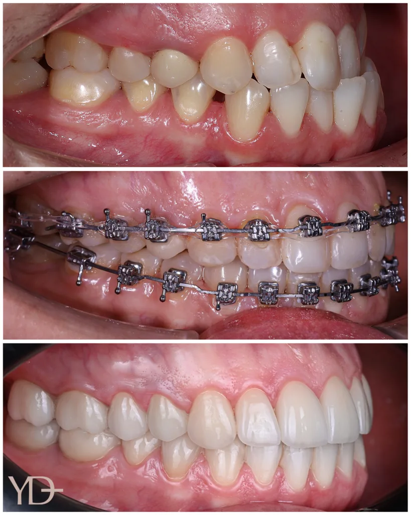 YAREMA DENTAL — ТОП-3 кращих стоматологій України для лікування складних стоматологічних випадків 2026