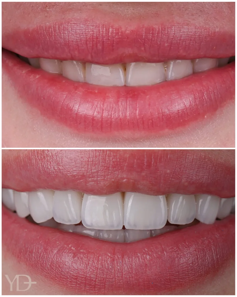 YAREMA DENTAL — ТОП-3 кращих стоматологій України для лікування складних стоматологічних випадків 2026