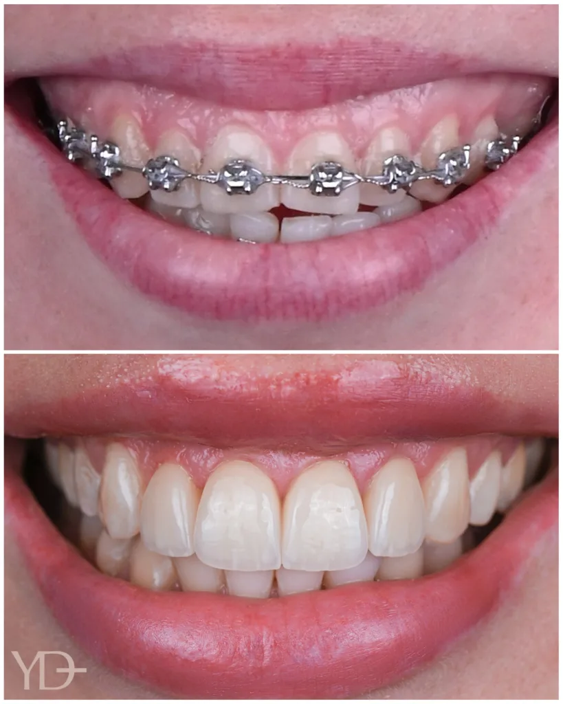YAREMA DENTAL — ТОП-3 кращих стоматологій України для лікування складних стоматологічних випадків 2026